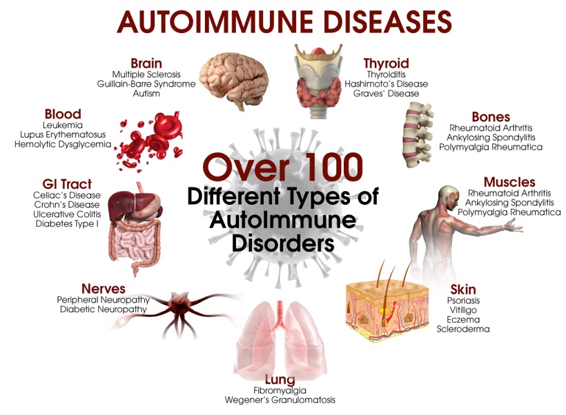 Autoimmune Disease Cure and Treatment in Chittoor Andhra Pradesh