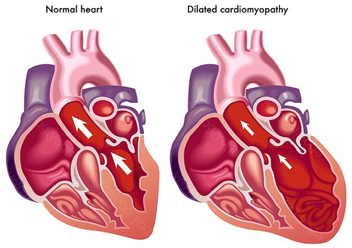 Heart Disease Cure and Treatment in Bidhan Nagar West Bengal