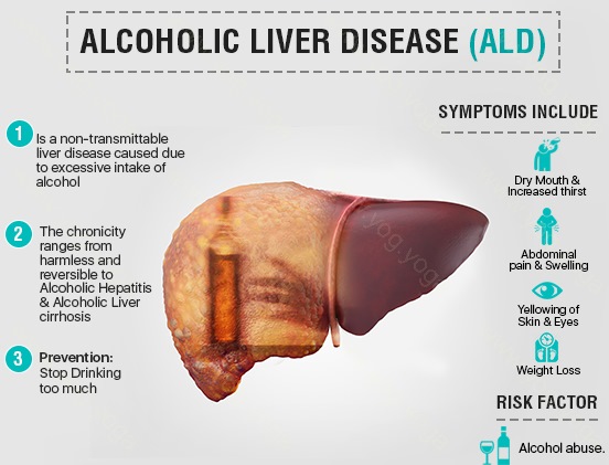 Liver Disease Cure and Treatment in Visakhapatnam Andhra Pradesh