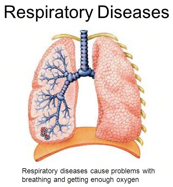 Respiratory Disease Cure and Treatment in Kollam Kerla